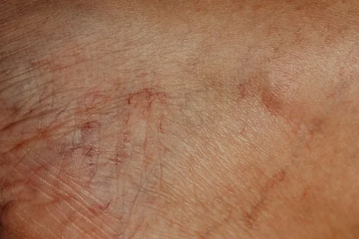 What Happens If You Dont Have Enough Oils In Your Body